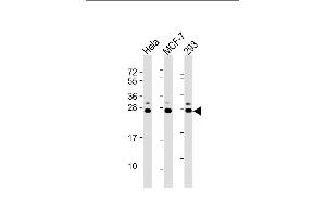 All lanes : Anti-KDELR1 Antibody (C-term) at 1:2000 dilution Lane 1: Hela whole cell lysate Lane 2: MCF-7 whole cell lysate Lane 3: 293 whole cell lysate Lysates/proteins at 20 μg per lane. (KDELR (AA 185-211), (C-Term) 抗体)