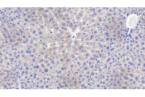 Detection of ITGb1 in Mouse Liver Tissue using Polyclonal Antibody to Integrin Beta 1 (ITGb1) (ITGB1 抗体  (AA 454-714))