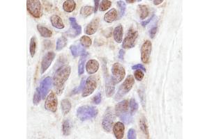 Immunohistochemistry (IHC) image for anti-CoaA (AA 150-200) antibody (ABIN7448480) (CoaA (AA 150-200) 抗体)