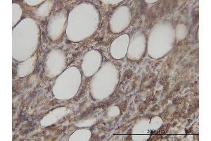 Immunostaining (ISt) image for anti-Aminoacylase 1 (ACY1) (AA 1-408) antibody (ABIN559777)