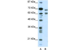 WB Suggested Anti-KCNK5 Antibody Titration:  0. (KCNK5 抗体  (C-Term))