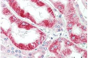 Human Kidney: Formalin-Fixed, Paraffin-Embedded (FFPE) (CLPB 抗体  (AA 575-624))