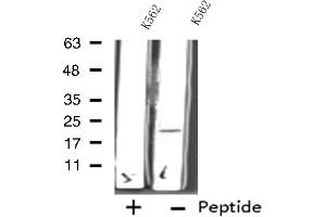 Western blot analysis of extracts from K562 cells using RPL11 antibody.