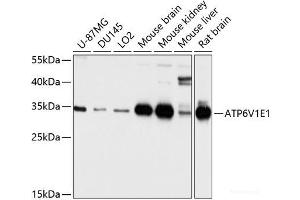 Western blot analysis of extracts of various cell lines using ATP6V1E1 Polyclonal Antibody at dilution of 1:1000. (ATP6V1E1 抗体)