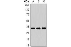 Western blot analysis of RASSF1 expression in Hela (A), HepG2 (B), SW480 (C) whole cell lysates. (RASSF1 抗体)