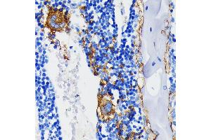 Immunohistochemistry of paraffin-embedded rat bone marrow using Integrin beta 3 (ITGB3/CD61) (ITGB3/CD61) Rabbit mAb (ABIN7267928) at dilution of 1:100 (40x lens). (Integrin beta 3 抗体)