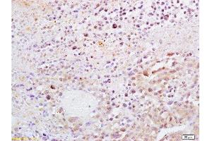 Formalin-fixed and paraffin embedded mouse lymphoma tissue labeled with Anti-Dnmt1 Polyclonal Antibody, Unconjugated  at 1:200, followed by conjugation to the secondary antibody and DAB staining (DNMT1 抗体  (AA 21-120))