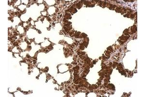 IHC-P Image PCBP2 antibody [N1C1] detects PCBP2 protein at nucleus and cytosol on mouse lung by immunohistochemical analysis. (PCBP2 抗体)