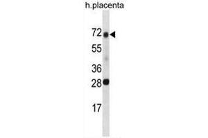 Western Blotting (WB) image for anti-serine Peptidase Inhibitor, Kunitz Type 1 (SPINT1) (AA 177-207), (Middle Region) antibody (ABIN954931)