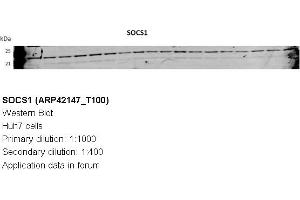 Image no. 3 for anti-Suppressor of Cytokine Signaling 1 (SOCS1) (N-Term) antibody (ABIN310288) (SOCS1 抗体  (N-Term))