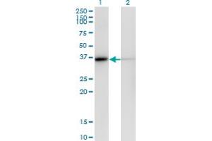 Western Blotting (WB) image for anti-Malate Dehydrogenase 1, NAD (Soluble) (MDH1) (AA 1-334) antibody (ABIN561768)