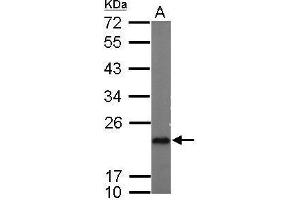 Western Blotting (WB) image for anti-Prostaglandin E Synthase 3 (Cytosolic) (PTGES3) antibody (ABIN2856401)