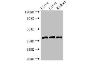 Western Blot Positive WB detected in: Rat liver tissue, Mouse liver tissue, Mouse kidney tissue All lanes: GNB4 antibody at 2 μg/mL Secondary Goat polyclonal to rabbit IgG at 1/50000 dilution Predicted band size: 38 kDa Observed band size: 38 kDa (GNB4 抗体  (AA 105-185))