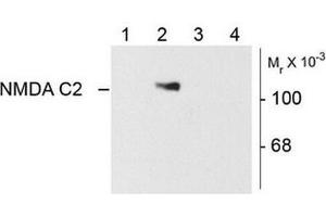 Image no. 1 for anti-NMDA Receptor 1 (NMDA R1) (Splice Variant C2) antibody (ABIN372676) (NMDA 1 Receptor 抗体  (Splice Variant C2))