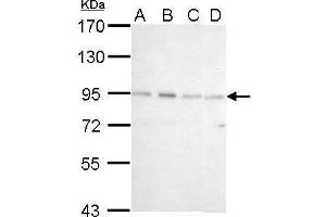 WB Image CSDE1 antibody [N2C1], Internal detects CSDE1 protein by Western blot analysis. (CDSE1 抗体  (Internal Region))