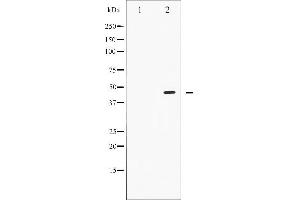 Western blot analysis of Smad2/3 phosphorylation expression in RAW264. (Smad2/3 抗体  (pThr8, Thr8))