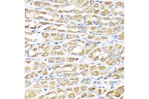 Immunohistochemistry (IHC) image for anti-Elongator Complex Protein 1 (ELP1) (AA 1093-1332) antibody (ABIN6142278)
