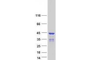 Validation with Western Blot