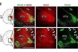 Immunofluorescence (Paraffin-embedded Sections) (IF (p)) image for anti-Sine Oculis-Related Homeobox 3 (SIX3) (Internal Region) antibody (ABIN6657911)