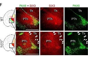 TCF7L2 controls the establishment of anatomical borders in the thalamus and habenula. (SIX3 抗体  (Internal Region))