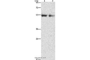 Western blot analysis of Human right lung and left lung cancer tissue, using ANGPT4 Polyclonal Antibody at dilution of 1:480 (Angiopoietin 4 抗体)