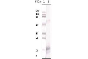 Western Blotting (WB) image for anti-Interferon gamma (IFNG) antibody (ABIN1107642) (Interferon gamma 抗体)
