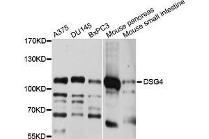 Western blot analysis of extracts of various cell lines, using DSG4 antibody. (Desmoglein 4 抗体)