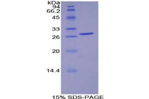 SDS-PAGE analysis of Human PDK1 Protein. (PDK1 蛋白)
