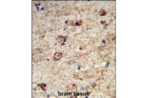 Formalin-fixed and paraffin-embedded human brain tissue reacted with LRRC4 Antibody , which was peroxidase-conjugated to the secondary antibody, followed by DAB staining. (LRRC4 抗体  (C-Term))