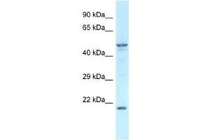 Western Blot showing Zfp113 antibody used at a concentration of 1. (Zfp113 抗体  (Middle Region))