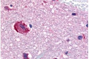 Human Brain, Caudate (formalin-fixed, paraffin-embedded) stained with GPR61 antibody ABIN213521 at 20 ug/ml followed by biotinylated goat anti-rabbit IgG secondary antibody ABIN481713, alkaline phosphatase-streptavidin and chromogen. (GPR61 抗体  (Cytoplasmic Domain))
