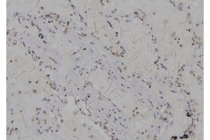ABIN6277206 at 1/100 staining Human lung tissue by IHC-P.