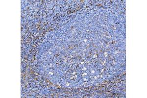 IHC analysis of S100A10 using anti-S100A10 antibody (ABIN5692833). (S100A10 抗体  (AA 4-94))