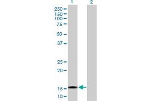 Western Blot analysis of TTC32 expression in transfected 293T cell line by TTC32 MaxPab polyclonal antibody. (TTC32 抗体  (AA 1-151))