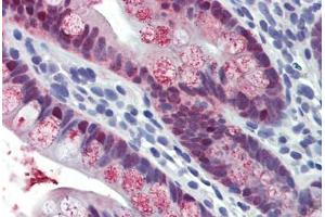Small intestine, Human: Formalin-Fixed, Paraffin-Embedded (FFPE) (HOXC8 抗体  (AA 35-84))