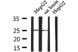 Western blot analysis of extracts from HepG2 and rat brain, using SOCS3 Antibody. (SOCS3 抗体  (C-Term))