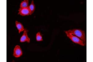 IF analysis of HIP1R using anti-HIP1R antibody (ABIN7601290). (HIP1R 抗体  (AA 316-734))