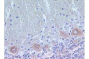 Rat brain zinc-fixed paraffin-embedded tissue (PKC delta 抗体  (AA 114-289))