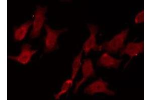 ABIN6275000 staining HepG2 by IF/ICC. (CNGA1 抗体  (Internal Region))