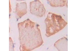 Used in DAB staining on fromalin fixed paraffin- embedded skeletal muscle tissue (IREB2 抗体  (AA 1-343))
