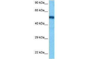 Host:  Rat  Target Name:  HNF1B  Sample Tissue:  Rat Liver  Antibody Dilution:  1ug/ml (HNF1B 抗体  (N-Term))