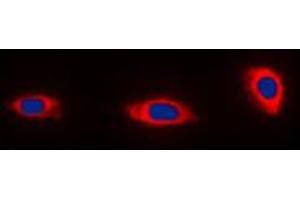 Immunofluorescent analysis of NDUFA4 staining in HeLa cells. (NDUFA4 抗体  (C-Term))