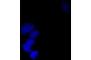 Immunofluorescence (IF) image for anti-Small Ubiquitin Related Modifier Protein 1 (SUMO1) (full length) antibody (FITC) (ABIN2452136) (SUMO1 抗体  (full length) (FITC))