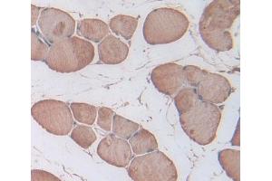 IHC-P analysis of skeletal muscle tissue, with DAB staining. (Triadin 抗体  (AA 486-687))