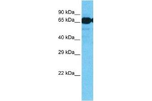 Host:  Rabbit  Target Name:  SLC7A8  Sample Type:  Fetal Liver Cell lysates  Antibody Dilution:  1. (SLC7A8 抗体  (Middle Region))