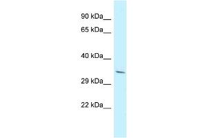 Host: Rabbit Target Name: PDLIM7 Sample Type: NCI-H226 Whole Cell lysates Antibody Dilution: 1. (PDLIM7 抗体  (N-Term))