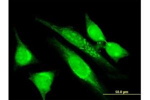 Immunofluorescence of monoclonal antibody to MGRN1 on HeLa cell. (Mahogunin RING Finger Protein 1 抗体  (AA 477-576))
