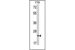 Western Blotting (WB) image for anti-Glutathione S-Transferase pi 1 (GSTP1) (AA 171-201), (C-Term) antibody (ABIN453076)