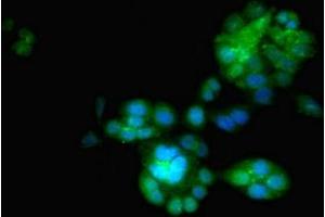 Immunofluorescent analysis of PC-3 cells using ABIN7151444 at dilution of 1:100 and Alexa Fluor 488-congugated AffiniPure Goat Anti-Rabbit IgG(H+L) (PHD1 抗体  (AA 283-407))