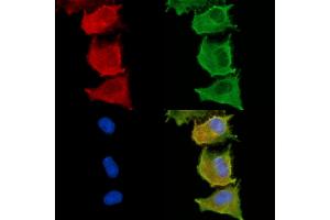 ABIN6263325 and ABIN6279013 staining  cells by IF/ICC. (MOGAT3 抗体  (C-Term))
